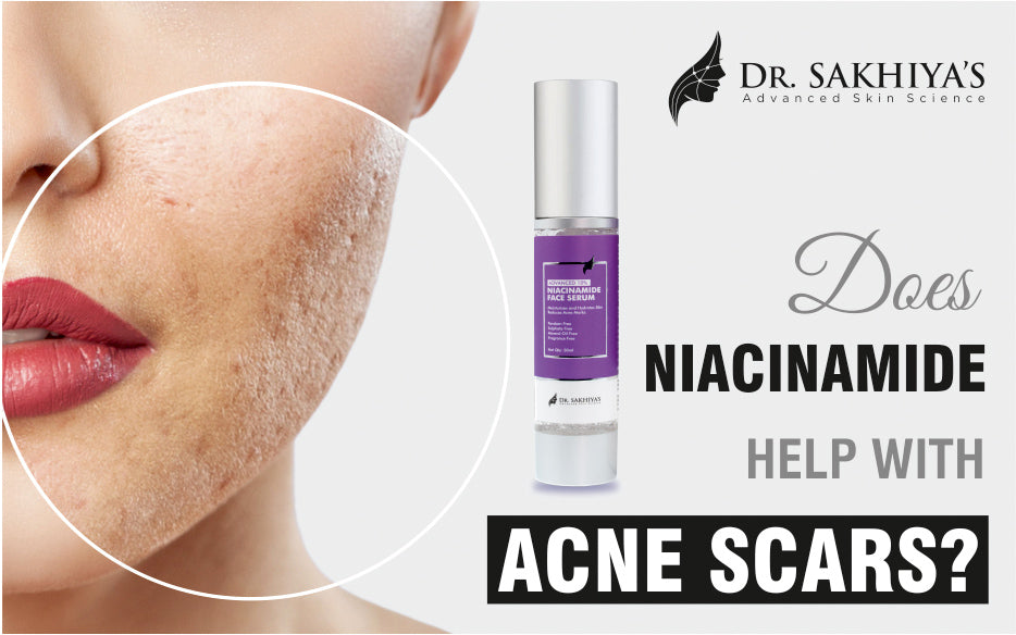 Does Niacinamide Help With Acne Scars? – Dr. Sakhiya’s – Advanced