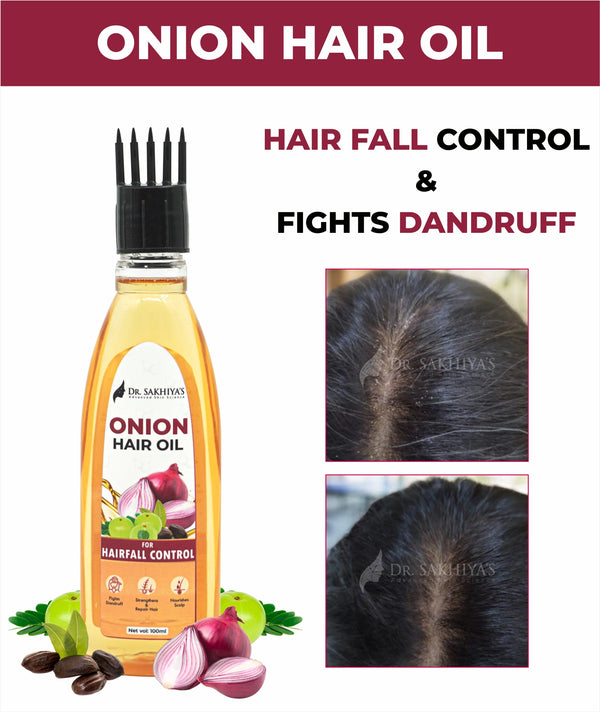 Dr. Sakhiya's Onion Hair Oil for Hair Fall Control | Enriched with Onion Extract, Amla & Almond | Strengthens, Nourishes, Fights Dandruff | 100 ml