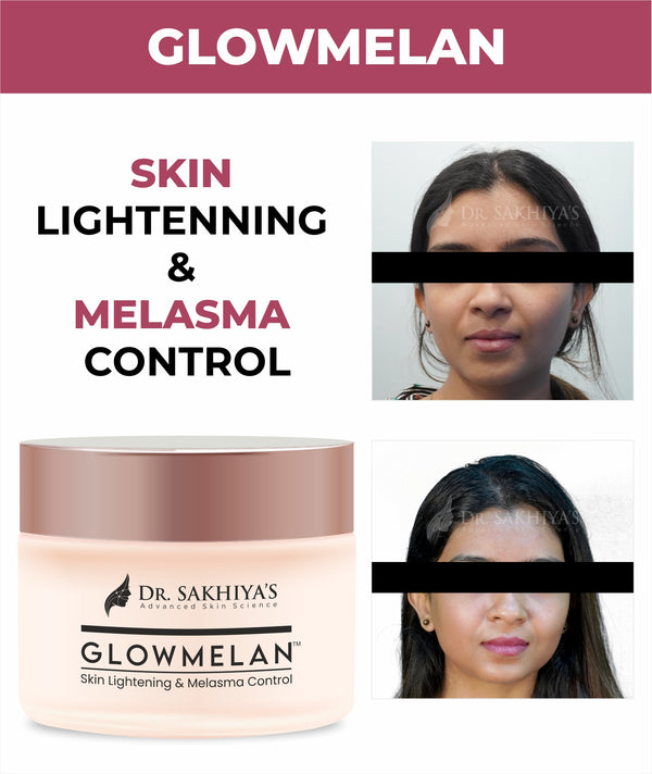 GLOWMELAN -  The Ultimate Skin Brightening and Depigmentation Cream