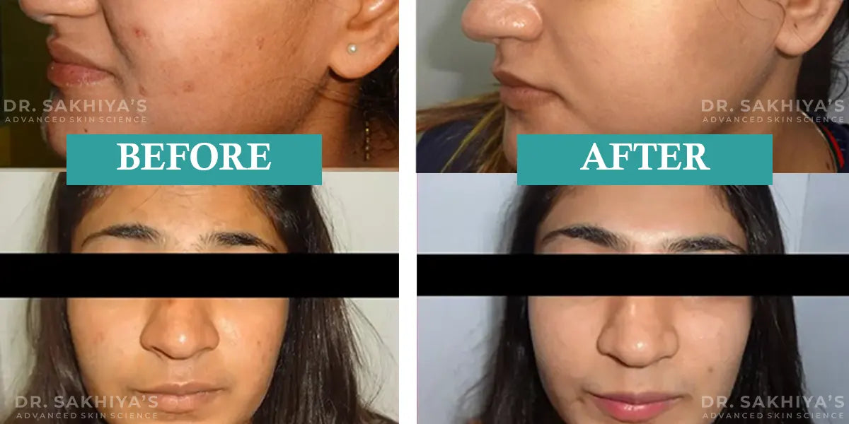 Dr. Sakhiya's Kojiclear - Skin Lightening & Brightening Cream with Kojic Acid, Glutathione, Niacinamide and Alpha Arbutin