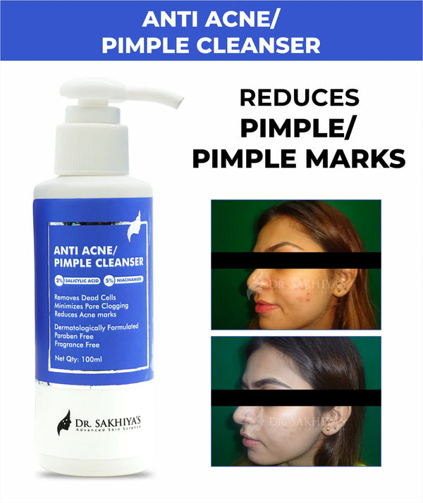 Anti Acne/Pimple Face Cleanser - With 2% Salicylic Acid And 5% Niacinamide