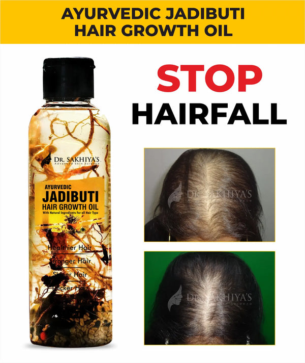 Dr. Sakhiya's Ayurvedic Jadibuti Hair Oil - For Natural Hair Growth - With Amla, Brahmi And Rosemary