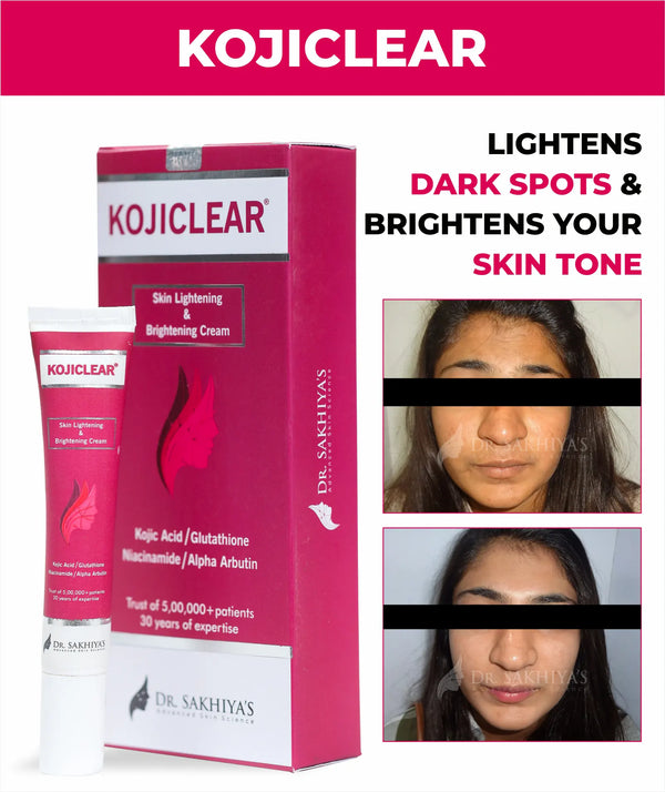 Dr. Sakhiya's Kojiclear - Skin Lightening & Brightening Cream with Kojic Acid, Glutathione, Niacinamide and Alpha Arbutin