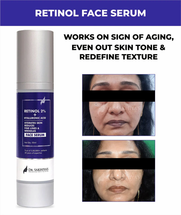 Retinol Face Serum - For Anti Aging & Youthful Skin - 2% Retinol + Hyaluronic Acid - 50ML