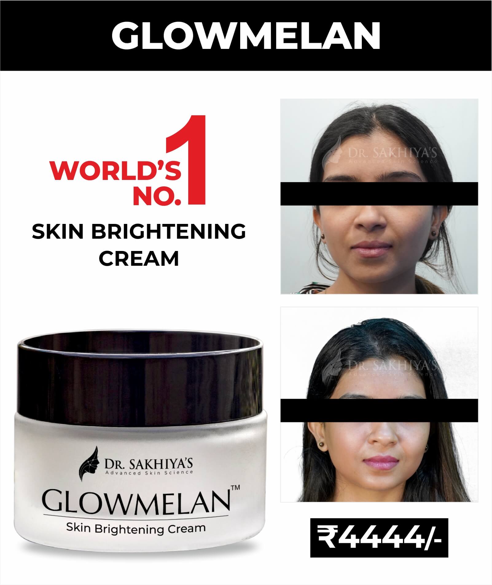 GLOWMELAN -  The Ultimate Skin Brightening and Depigmentation Cream