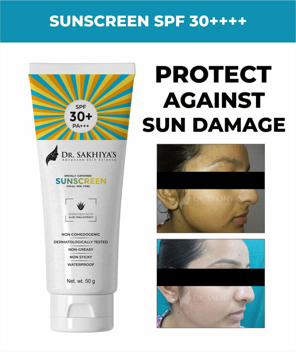 Protect Your Skin Daily: Why You Need SPF 30 Sunscreen for a Healthy Glow